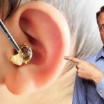 طريقة سحرية لإخراج الشمع من الأذن