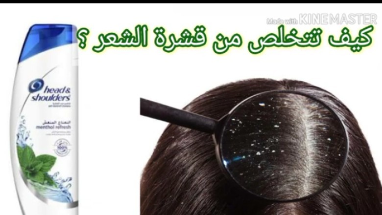 شامبو ضد القشرة وعلاج القشرة