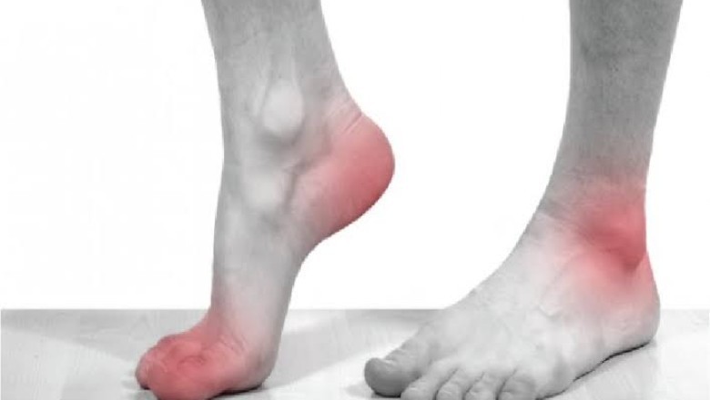 مرض النقرس أسبابه وأعراضه